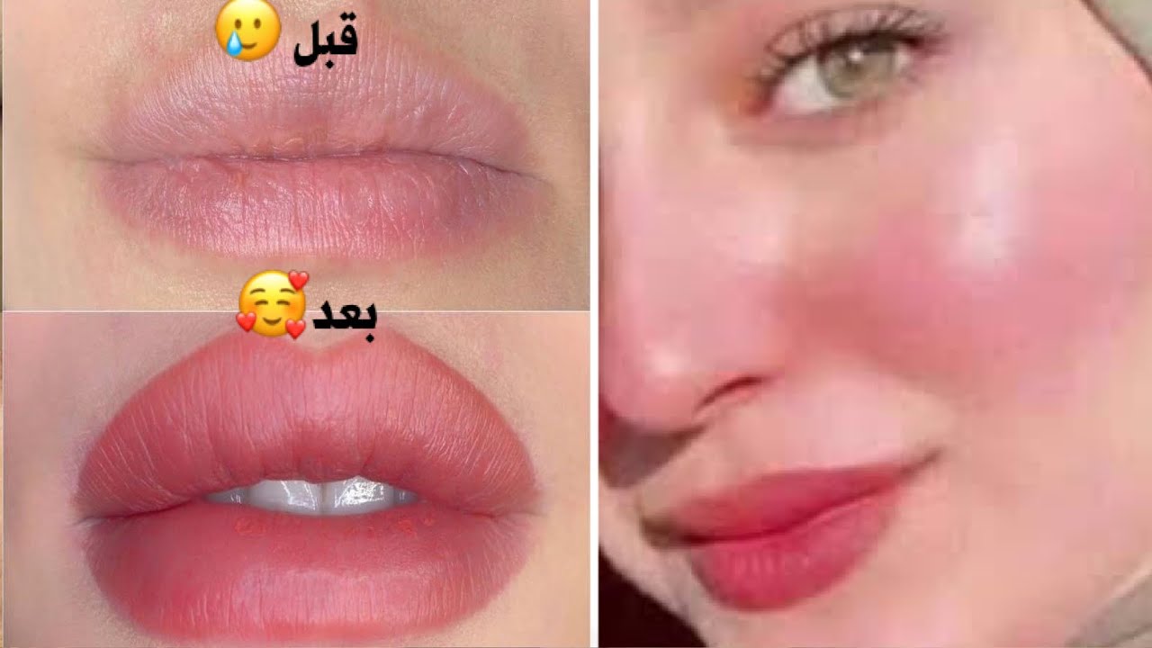 “ابتسامتك هتكون حكاية” جربي وصفات ترطيب الشفايف فى المنزل بمكونات طبيعية وآمنة 100% والنتيجة هتبهرك من أول استعمال!